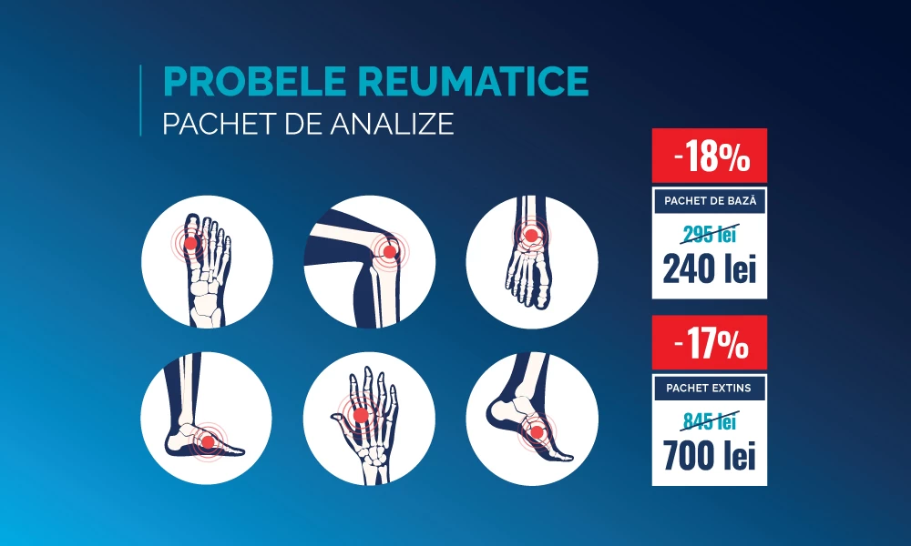 Preț special pentru Probele reumatice