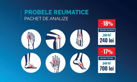 Preț special pentru Probele reumatice