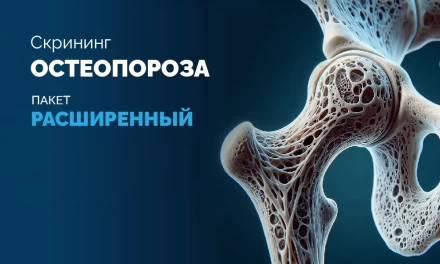 -15% на Расширенный Скрининг Остеопороза