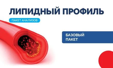 Липидный профиль, базовый