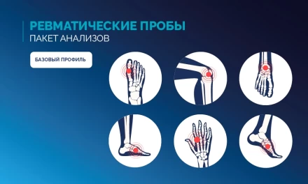 Ревматические пробы, базовый профиль