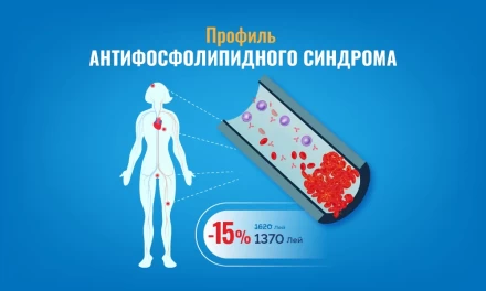 Профиль антифосфолипидного синдрома